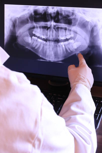 Best Emergency Treatment for Dental Infections or Abscesses in Hillsboro, WI